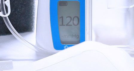 Negative Pressure Wound Therapy NZ