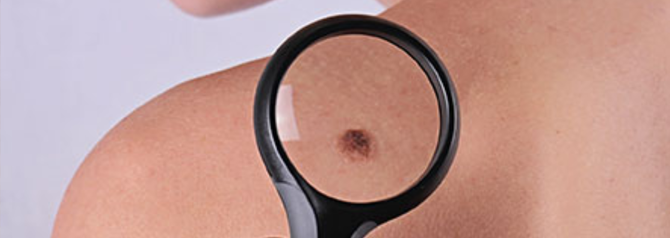 Dermatology