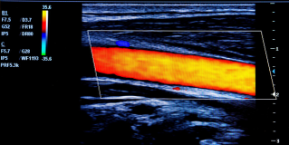 Endoscopy