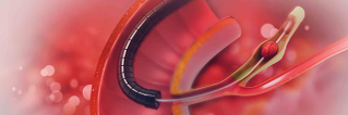 Endoscopy